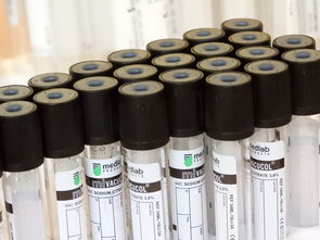 科技期刊,科学进步的催化剂  第1张 科技期刊,科学进步的催化剂  第1张